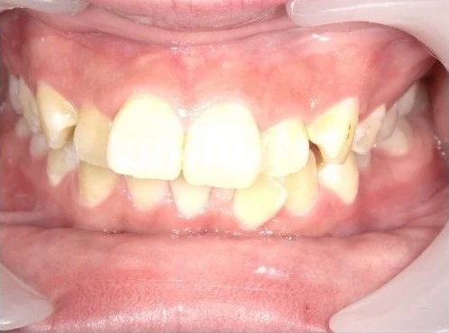 Before